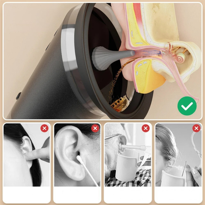Nettoyeur d'Oreille Électronique pour Enlever le Cérumen